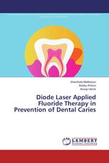Diode Laser Applied Fluoride Therapy in Prevention of Dental Caries