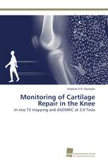 Monitoring of Cartilage Repair in the Knee