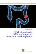 NFκB signaling in different stages of intestinal carcinogenesis