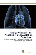 Image Processing for Atrial Fibrillation Ablation Procedures