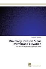 Minimally Invasive Sinus Membrane Elevation