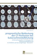 prognostische Bedeutung der CT-Perfusion bei Subarachnoidalblutung