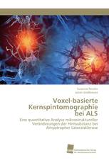 Voxel-basierte Kernspintomographie bei ALS