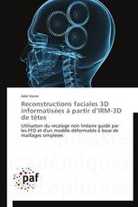Reconstructions faciales 3D informatisées à partir d’IRM-3D de têtes