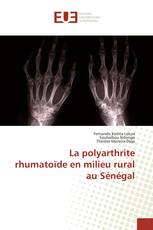 La polyarthrite rhumatoïde en milieu rural au Sénégal