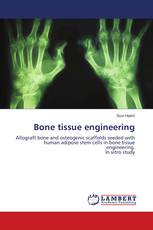 Bone tissue engineering