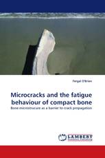 Microcracks and the fatigue behaviour of compact bone