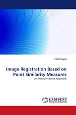 Image Registration Based on Point Similarity Measures