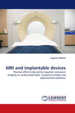 MRI and implantable devices