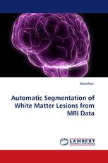 Automatic Segmentation of White Matter Lesions from MRI Data