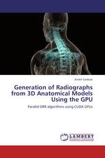 Generation of Radiographs from 3D Anatomical Models Using the GPU