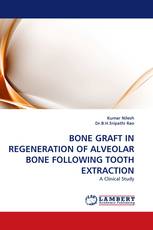 BONE GRAFT IN REGENERATION OF ALVEOLAR BONE FOLLOWING TOOTH EXTRACTION