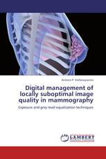 Digital management of locally suboptimal image quality in mammography