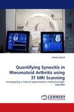 Quantifying Synovitis in Rheumatoid Arthritis using 3T MRI Scanning