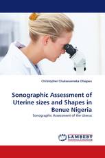 Sonographic Assessment of Uterine sizes and Shapes in Benue Nigeria