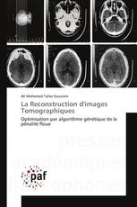 La Reconstruction d'images Tomographiques