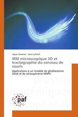 IRM microscopique 3D et tractographie du cerveau de souris