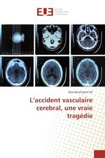 L’accident vasculaire cerebral, une vraie tragédie