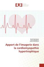 Apport de l’imagerie dans la cardiomyopathie hypertrophique