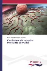 Carcinoma Micropapilar Infiltrante de Mama