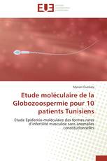 Etude moléculaire de la Globozoospermie pour 10 patients Tunisiens