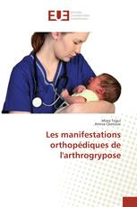 Les manifestations orthopédiques de l'arthrogrypose