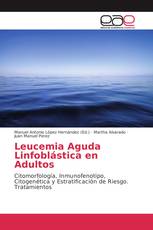Leucemia Aguda Linfoblástica en Adultos