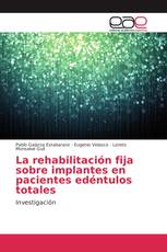 La rehabilitación fija sobre implantes en pacientes edéntulos totales