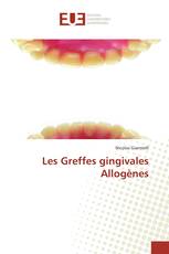 Les Greffes gingivales Allogènes