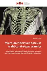 Micro-architecture osseuse trabéculaire par scanner