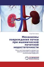 Механизмы повреждения почки при ишемической почечной недостаточности