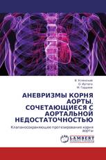 АНЕВРИЗМЫ КОРНЯ АОРТЫ, СОЧЕТАЮЩИЕСЯ С АОРТАЛЬНОЙ НЕДОСТАТОЧНОСТЬЮ