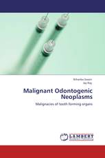 Malignant Odontogenic Neoplasms