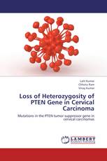 Loss of Heterozygosity of PTEN Gene in Cervical Carcinoma