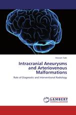 Intracranial Aneurysms and Arteriovenous Malformations