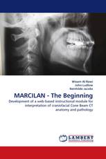 MARCILAN - The Beginning