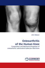 Osteoarthritis of the Human Knee