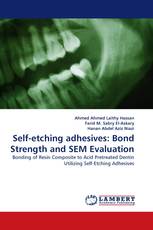 Self-etching adhesives: Bond Strength and SEM Evaluation