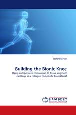 Building the Bionic Knee