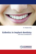 Esthetics in implant dentistry