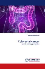 Colorectal cancer