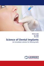 Science of Dental Implants
