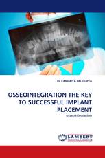 OSSEOINTEGRATION THE KEY TO SUCCESSFUL IMPLANT PLACEMENT
