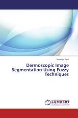 Dermoscopic Image Segmentation Using Fuzzy Techniques