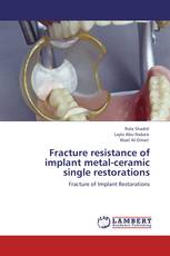 Fracture resistance of implant metal-ceramic single restorations