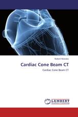Cardiac Cone Beam CT