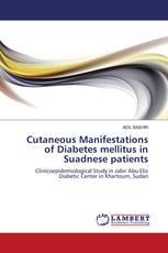 Cutaneous Manifestations of Diabetes mellitus in Suadnese patients