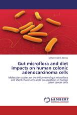 Gut microflora and diet impacts on human colonic adenocarcinoma cells