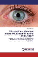 Microincision Bimanual Phacoemulsification Safety and Efficacy