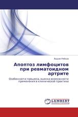 Апоптоз лимфоцитов при ревматоидном артрите